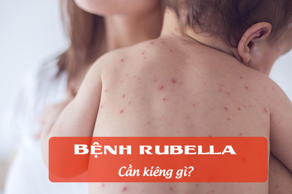 Bệnh rubella cần kiêng gì? 1